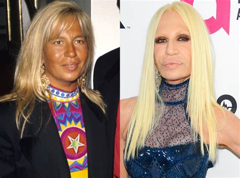 versace donatella before and after|current pictures of donatella versace.